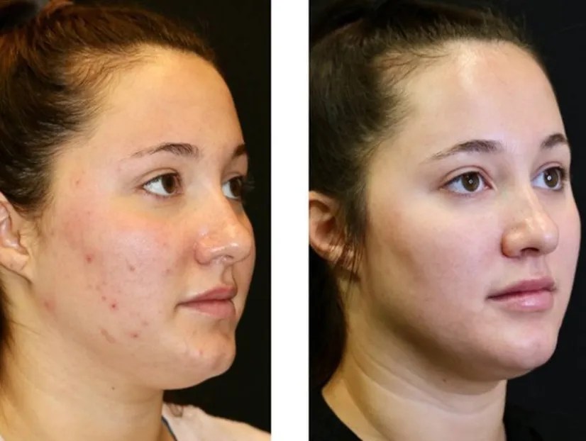 Advanced SaltFacial Therapy Abu Dhabi