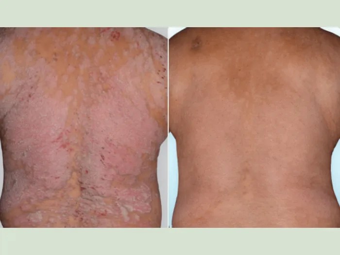 Effective Care for Skin Rashes Abu Dhabi