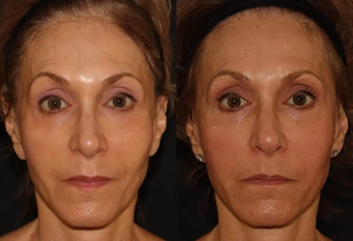 Perfect Drs Emface Anti-Aging Solution