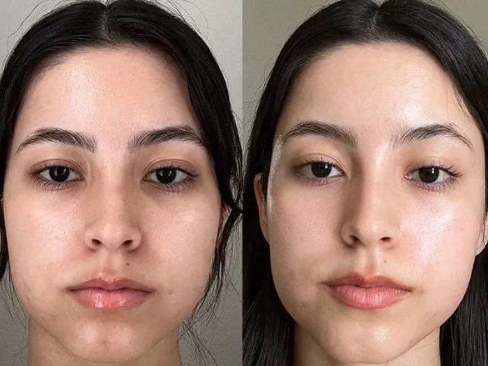 Red Carpet Facial Glow Treatment Dubai