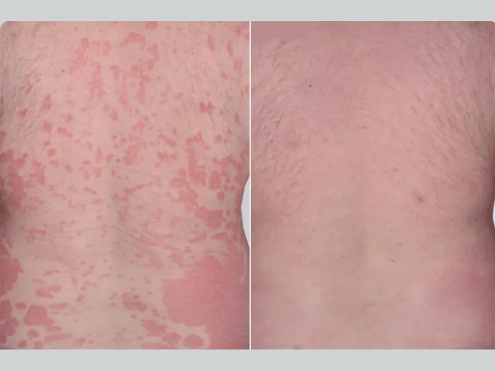 Perfect Drs Rash Healing Solution