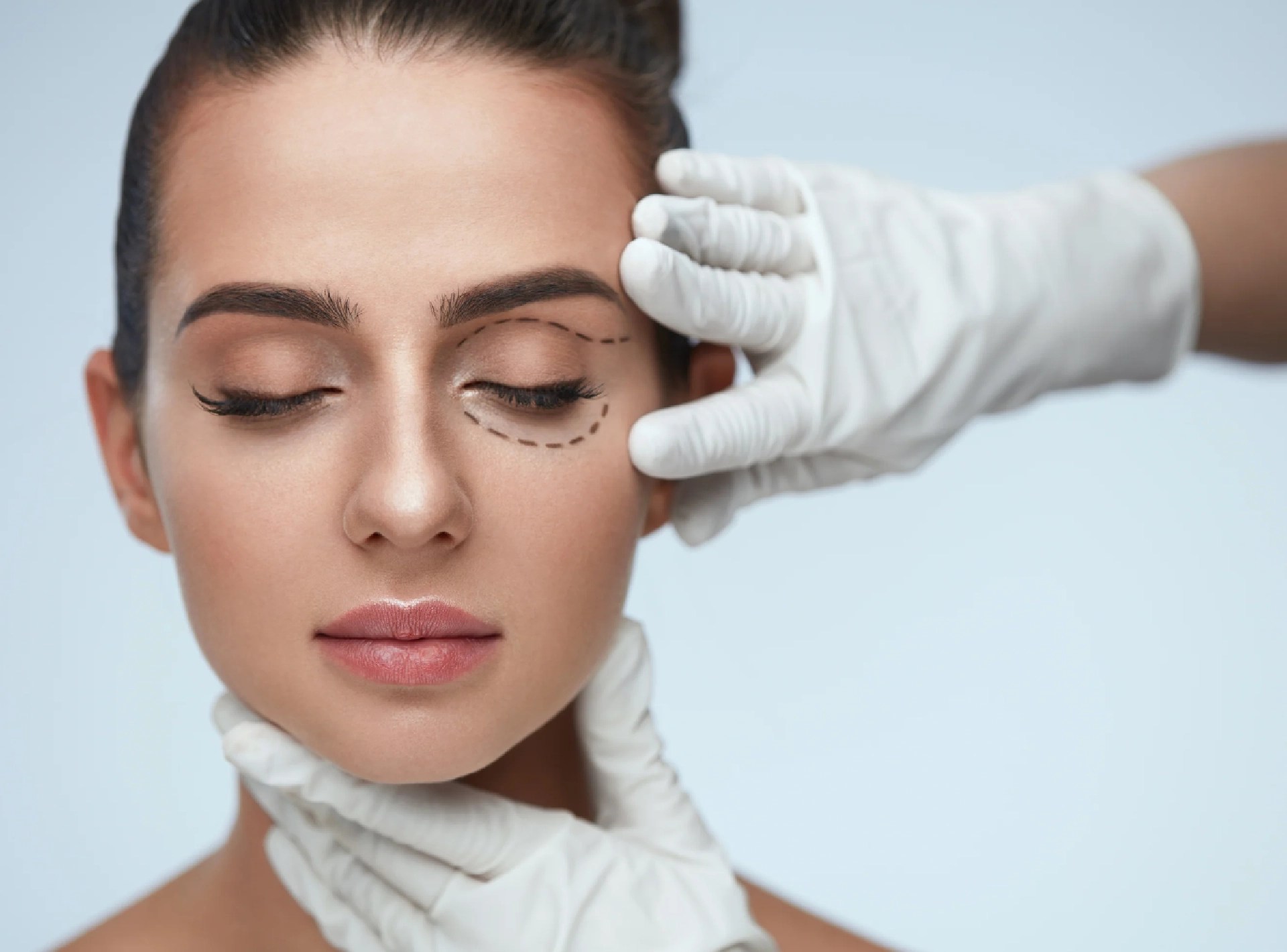 Have a Smooth Blepharoplasty Recovery