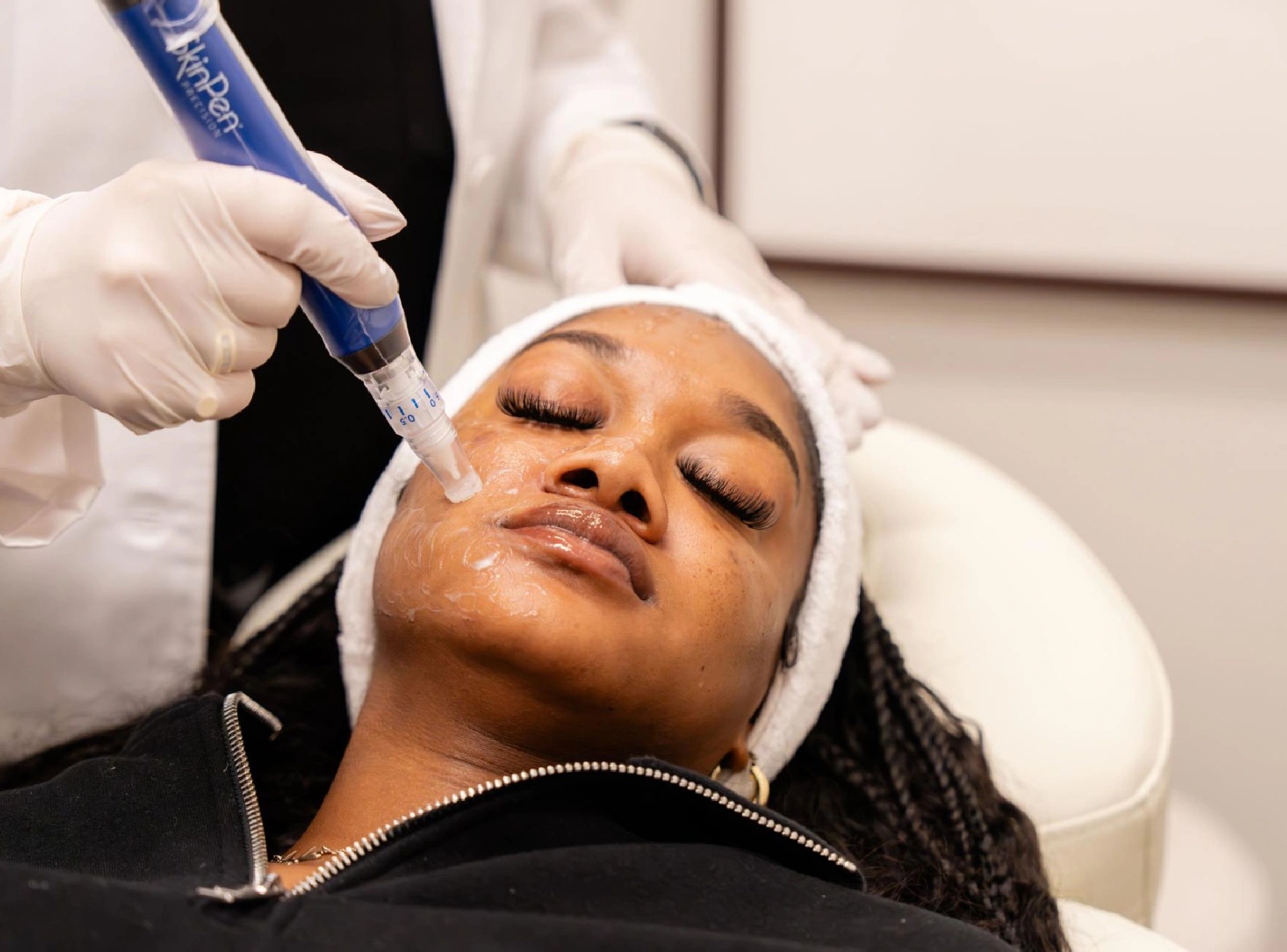 Restore aging skin? Try microneedling