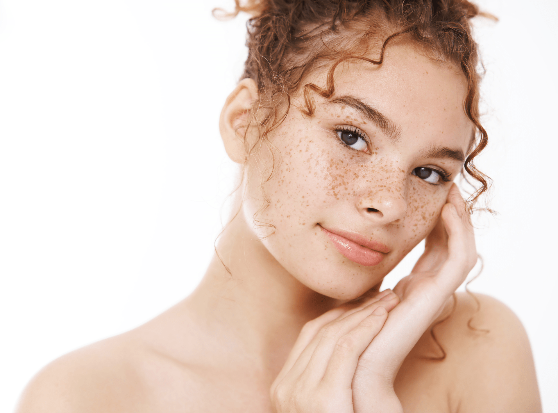 FAQs About Hyperpigmentation