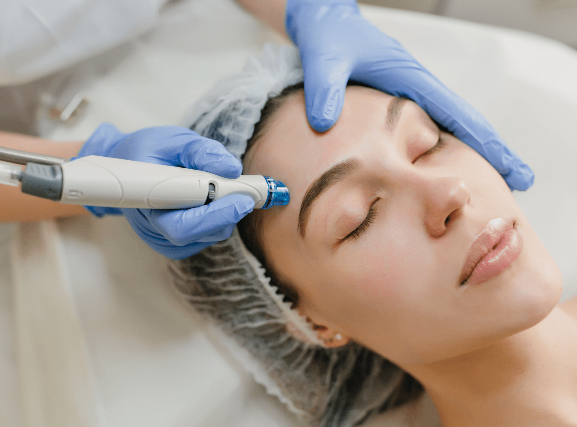 Benefits Of Microneedling For Skin