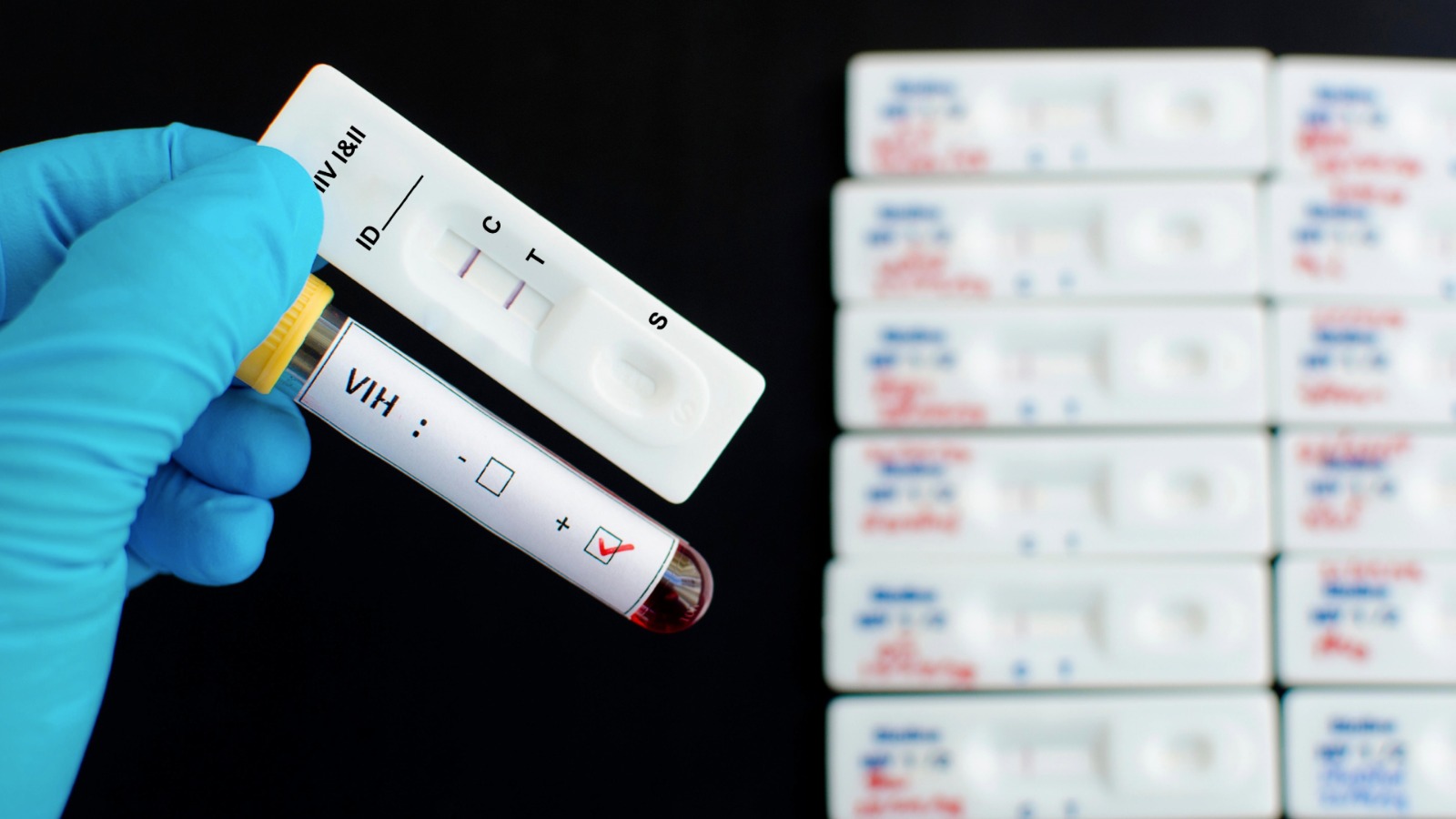 Detección de VIH y hepatitis sería insuficiente en Europa, alertan autoridades –