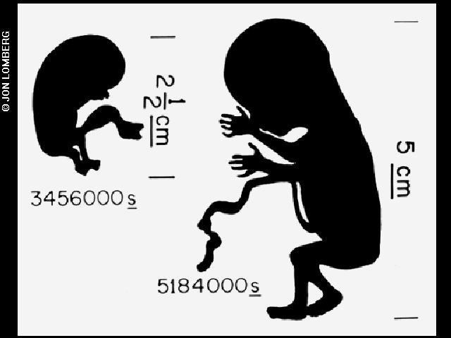 Diagrams of fetus used on Voyager Golden Record