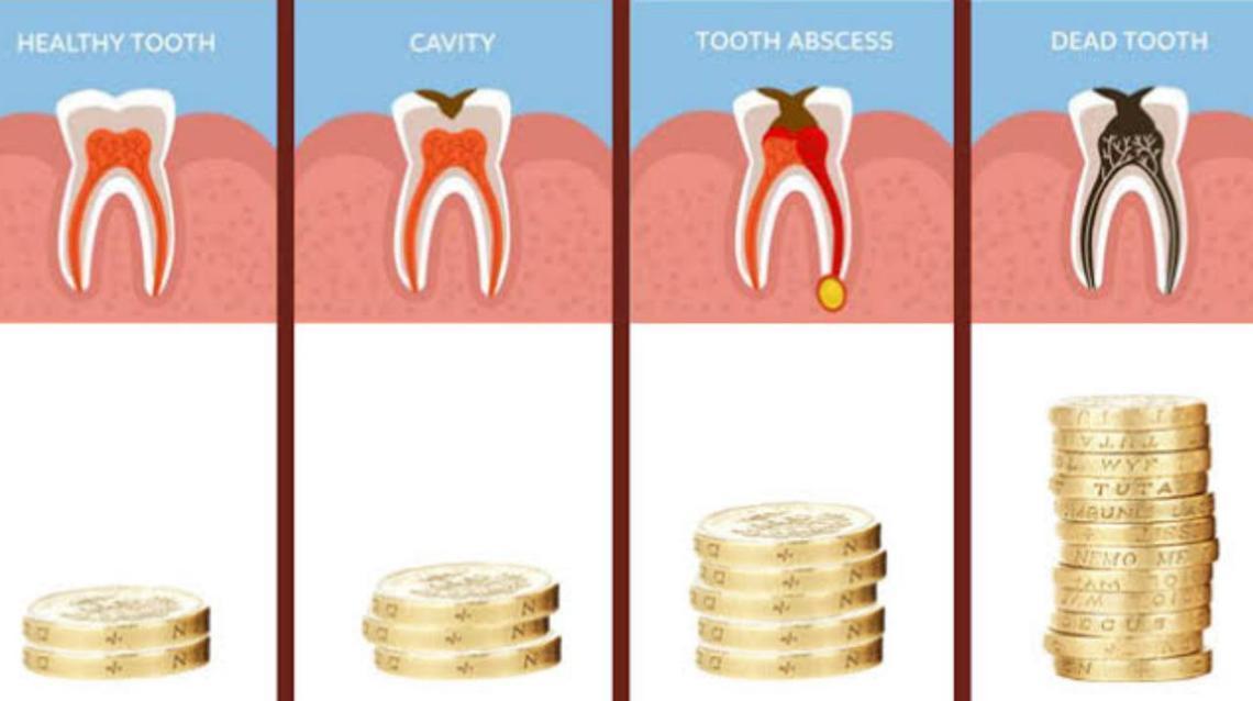 Is dentistry really expensive?