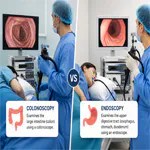 Colonoscopy vs Endoscopy: Key Differences Explained