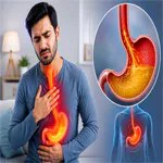 Frequent Acidity: Is It a Sign of a Serious Problem?