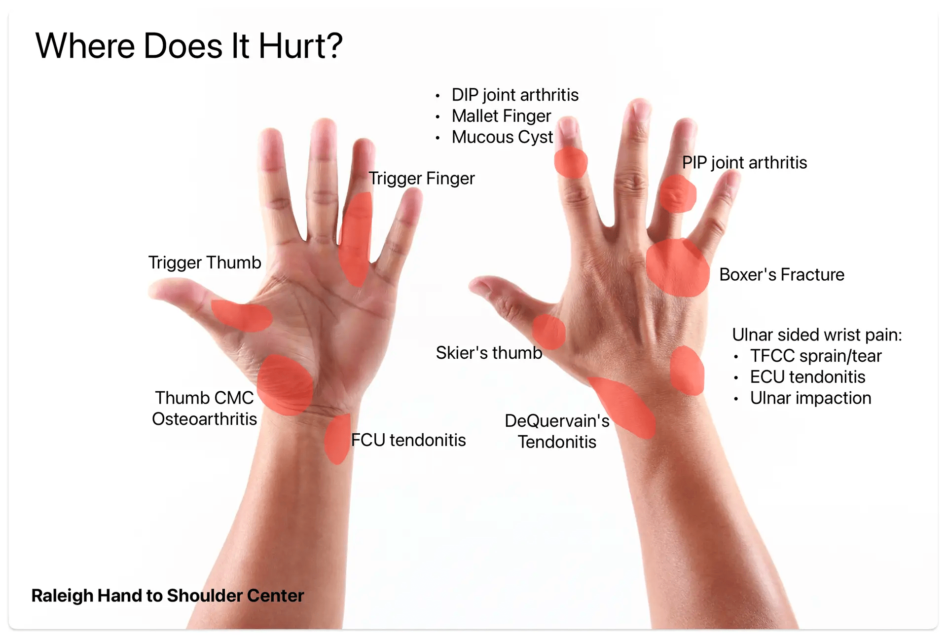 "understanding the cause of itchy right hand and when to see a doctor"