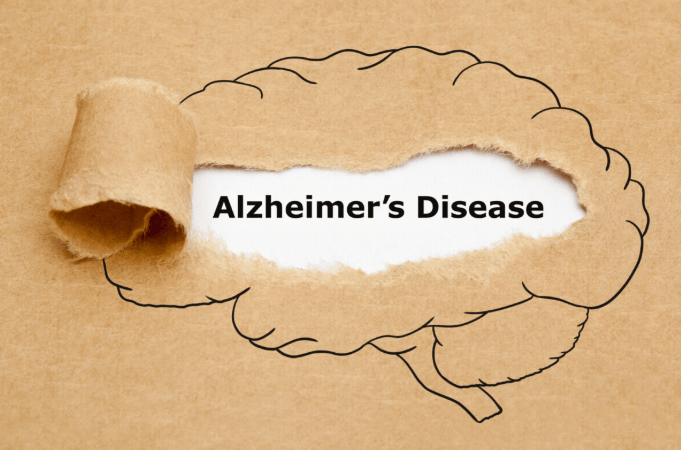 AI Unlocks Decades-Old Alzheimer’s Mystery: Why Some Brains Never Break Down