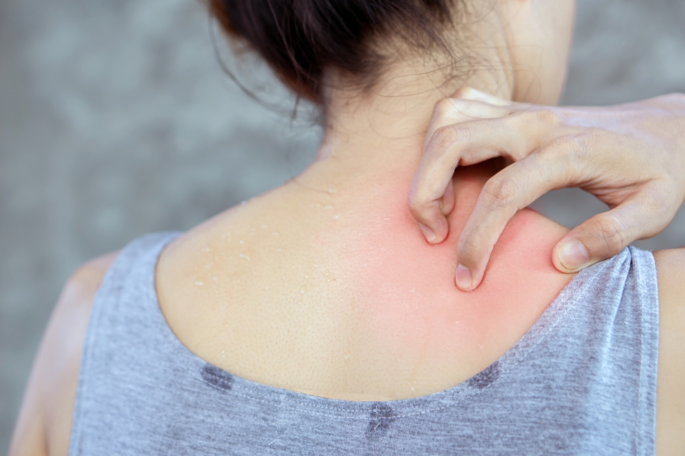skin-rashes-that-itch-redorbit