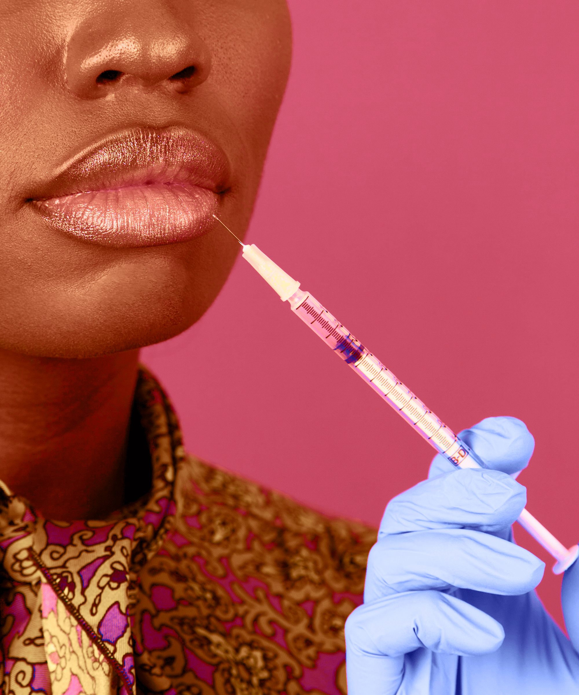 Here's what you need to know about getting lip fillers and botox, from the experts. Confessions Of A Lip Filler Doctor