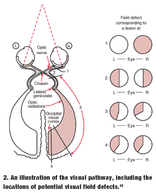 We may earn commission on some of the items you choose to buy. Lesson: Ischemia of the Eye and Brain