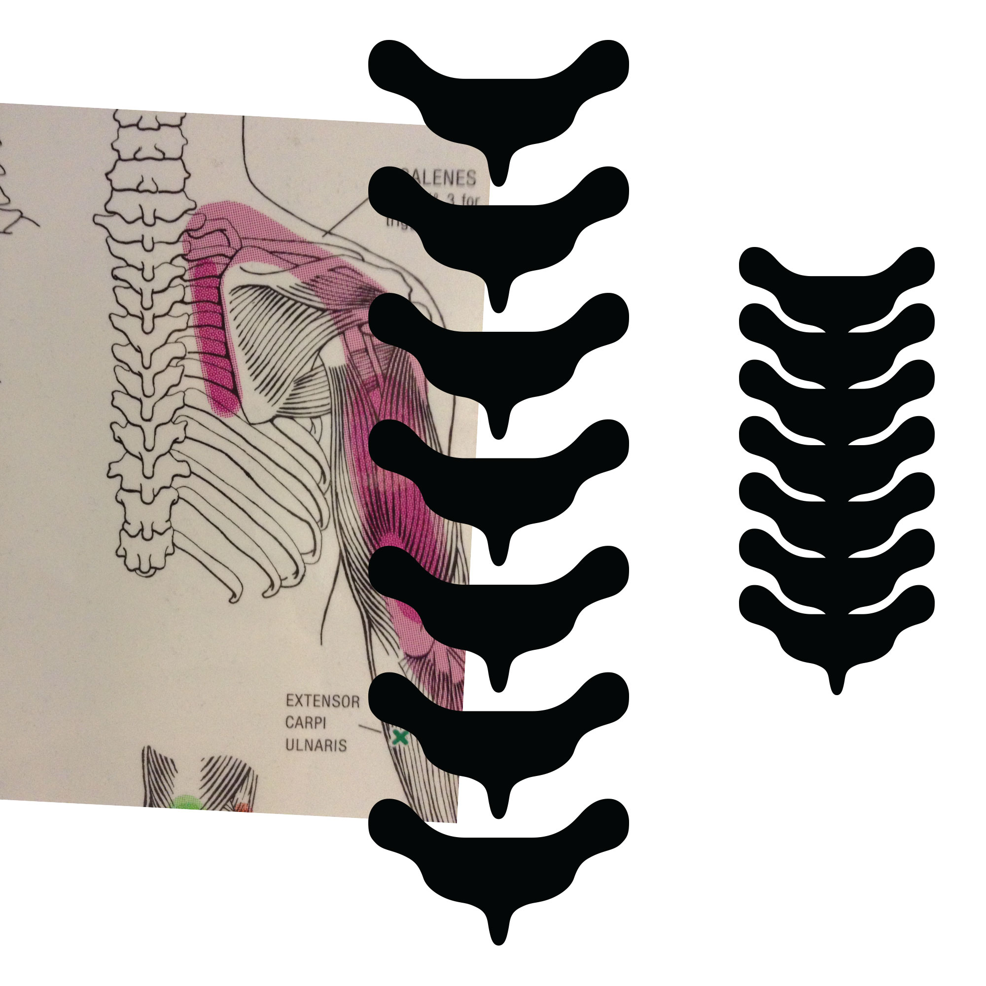 Etter tilbakemelding på at logoen ligner et romvesen så vi på hele ryggsøylen i stedet for en enkelt ryggvirvel