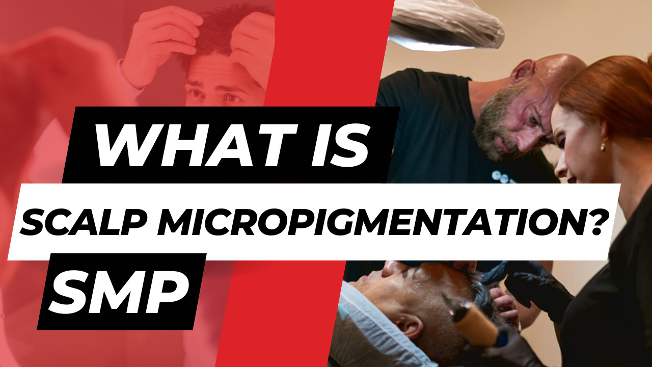 what is scalp micropigmentation smp scalp micropigmentation in raleigh