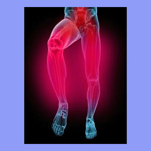 Sciatica flare-up