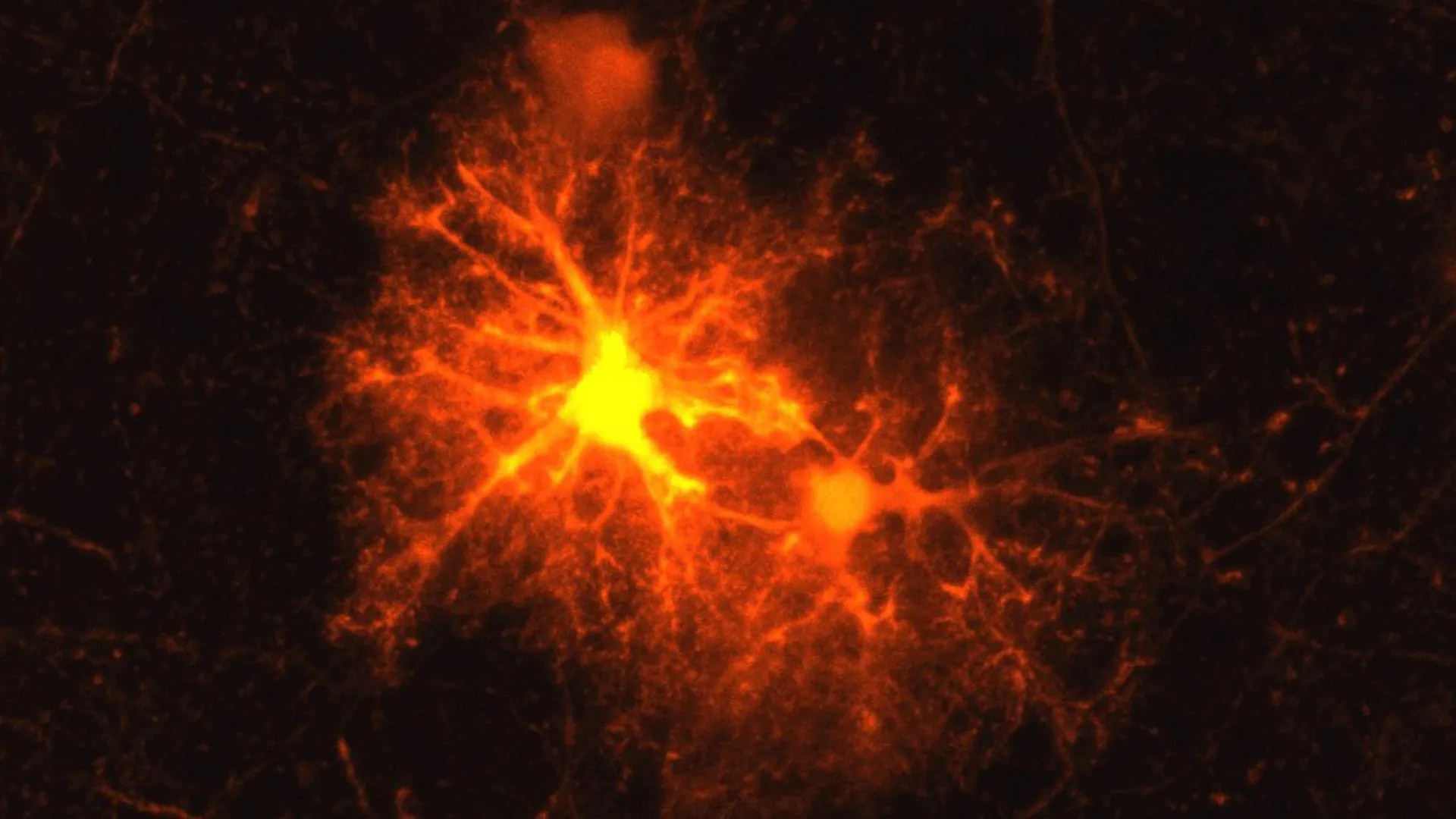 How Stress Hormone CRH Aids Brain Repair & Myelin Regeneration | New Study Reveals (2026)