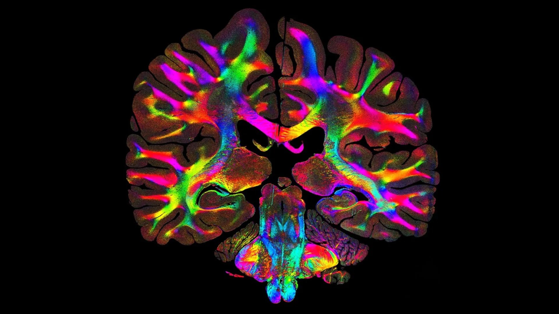 How Light Reveals Hidden Brain Fibers: A Breakthrough in Microscale Neuroimaging (ComSLI) (2026)