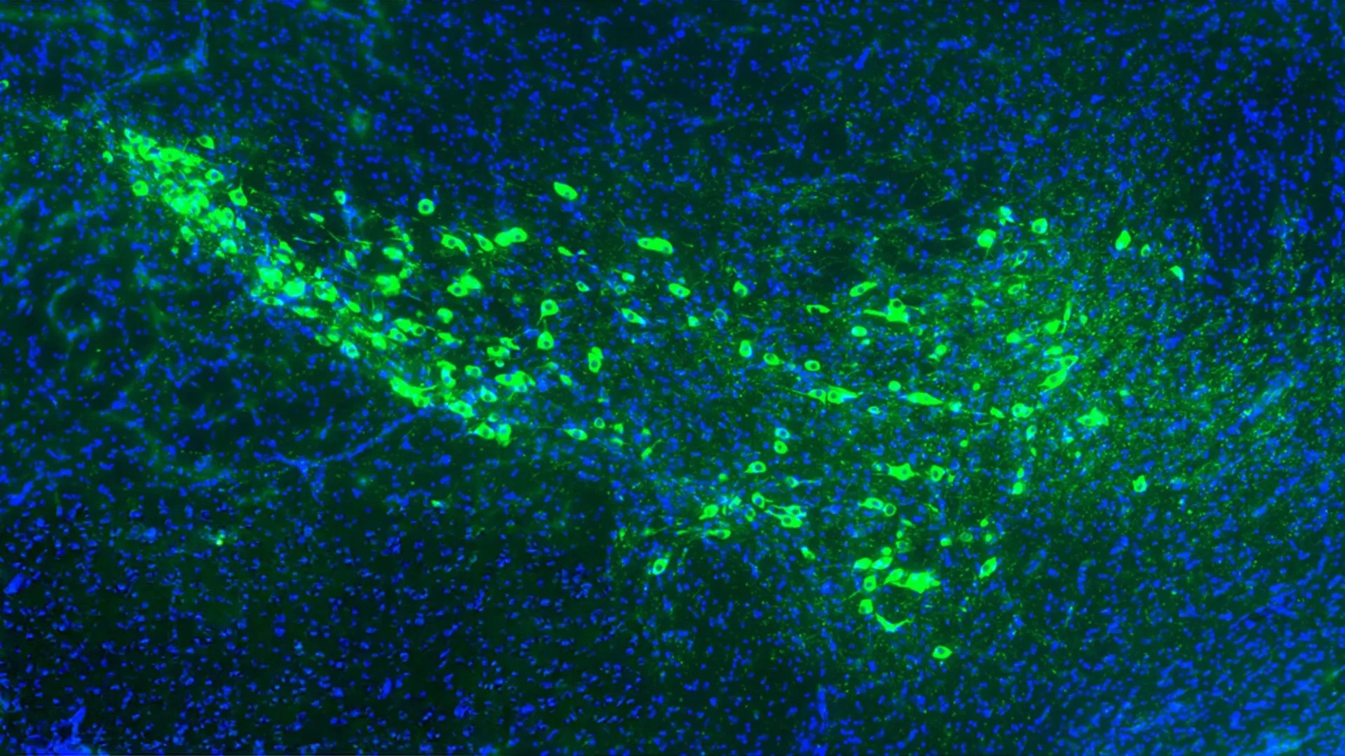Yale Scientists Discover How Parkinson's Disease Spreads Through the Brain (2026)