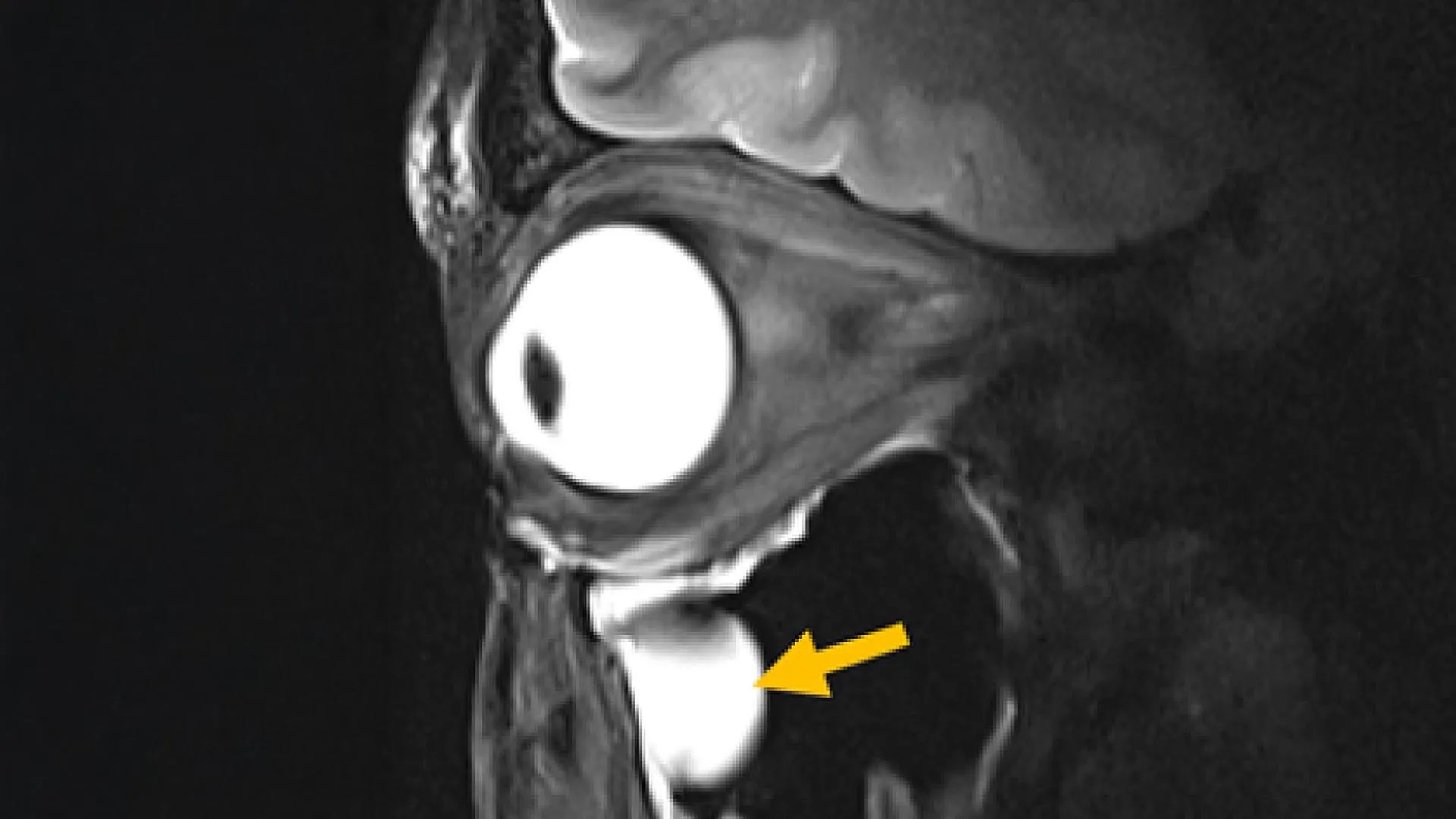 Revolutionary MRI Breakthrough: Sharper Brain & Eye Imaging Explained! (2026)
