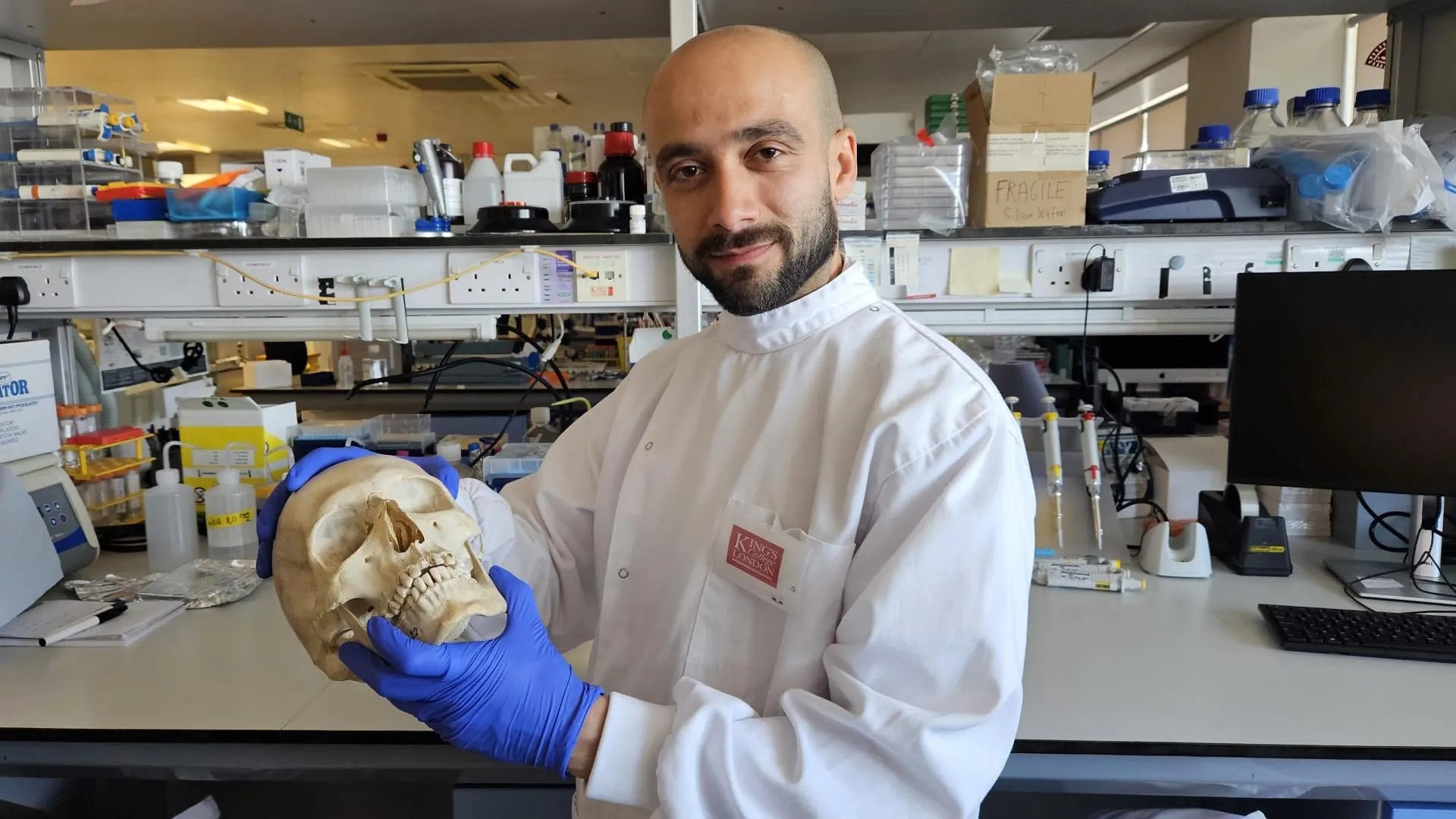 Sheep's Wool: The Future of Bone Regeneration? (2026)