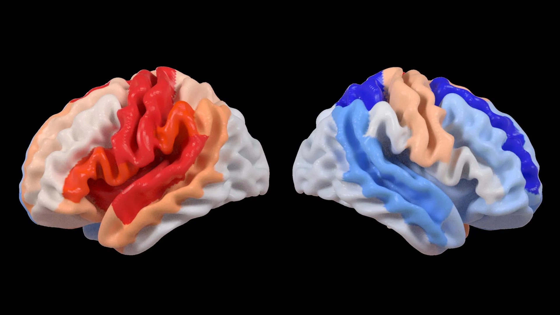 Stroke “Rejuvenates” the Undamaged Brain? AI Reveals Hidden Neuroplasticity (2026)