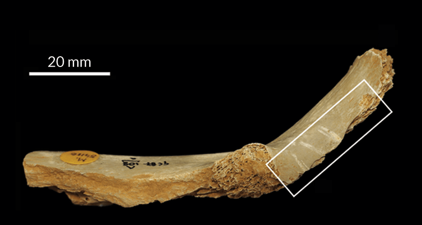 leg bone