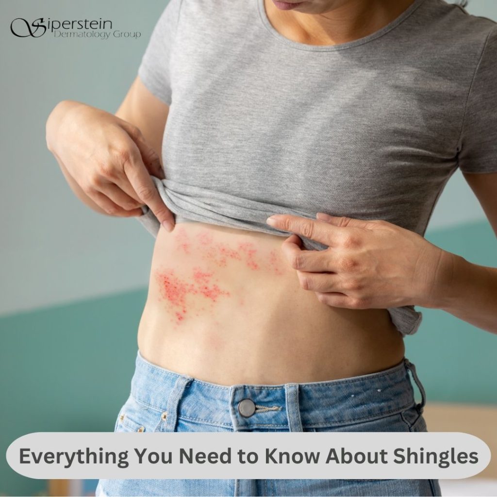 Everything you need to know about shingles