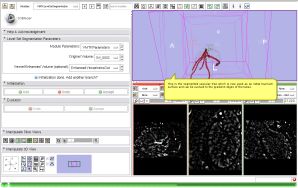 Modules Vmtklevelsetsegmentation Slicer Wiki - Best Geometric Textures in Mobile