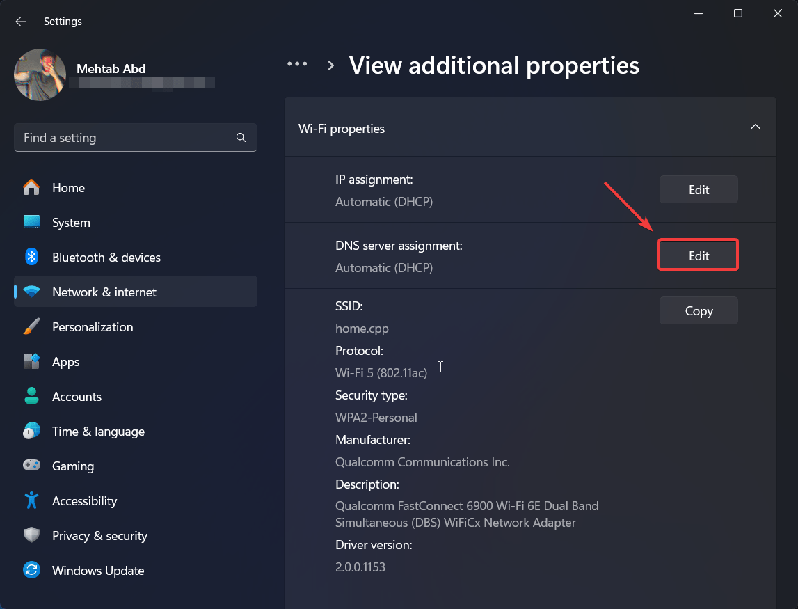 Click on Edit next to DNS server assignment
