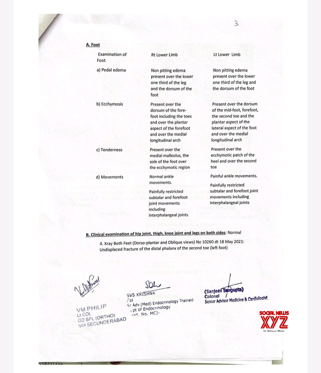 YSRCP MP K Raghu Rama Krishna Raju's Medical Report From Army Hospital