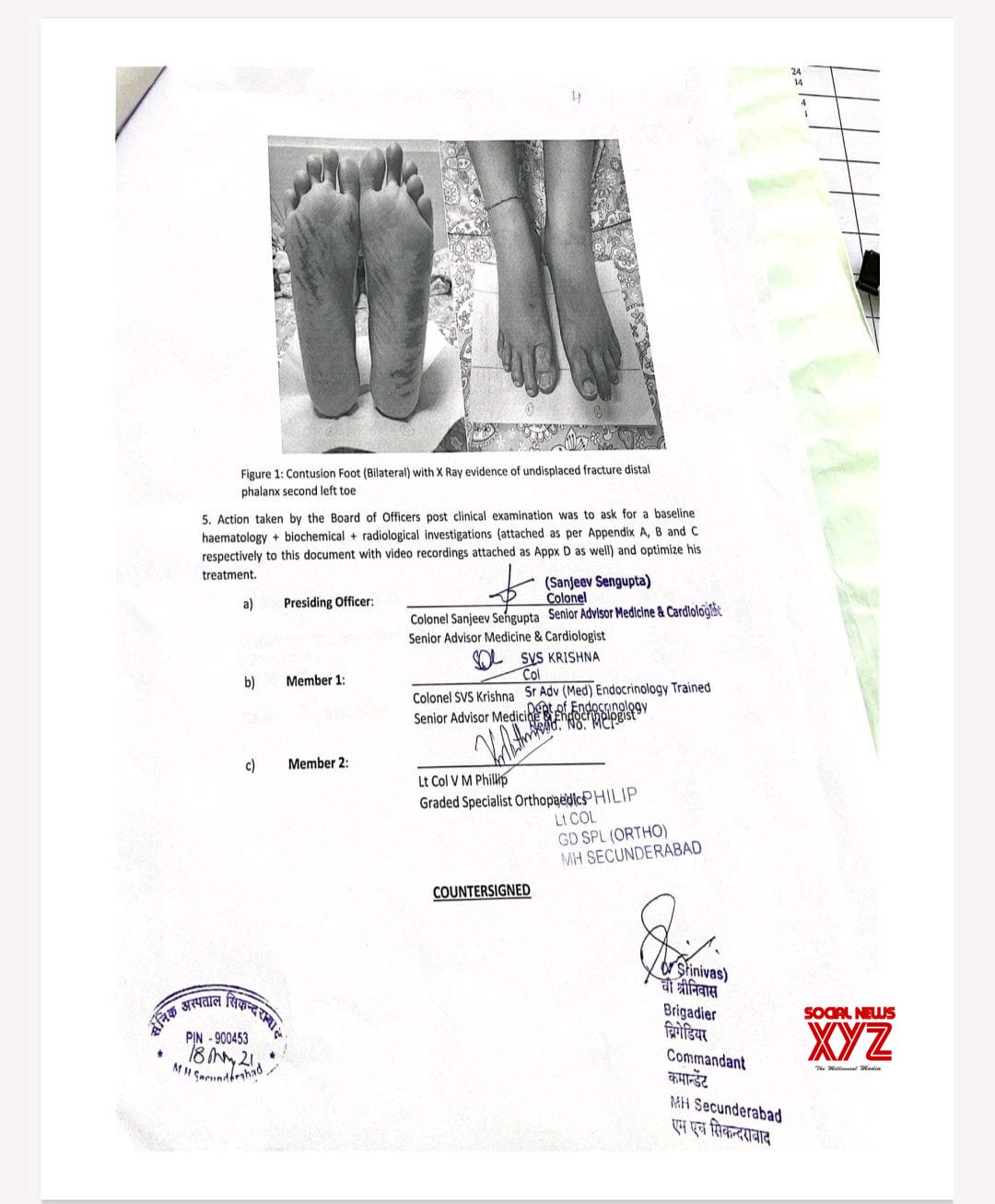 YSRCP MP K Raghu Rama Krishna Raju's Medical Report From Army Hospital