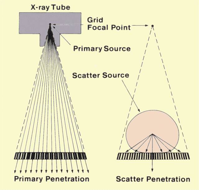 Image result for scatter x ray