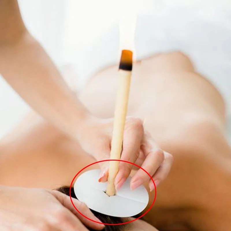 Sveće Za Čišćenje Uha Od Voska 10 Komada - Slika 6