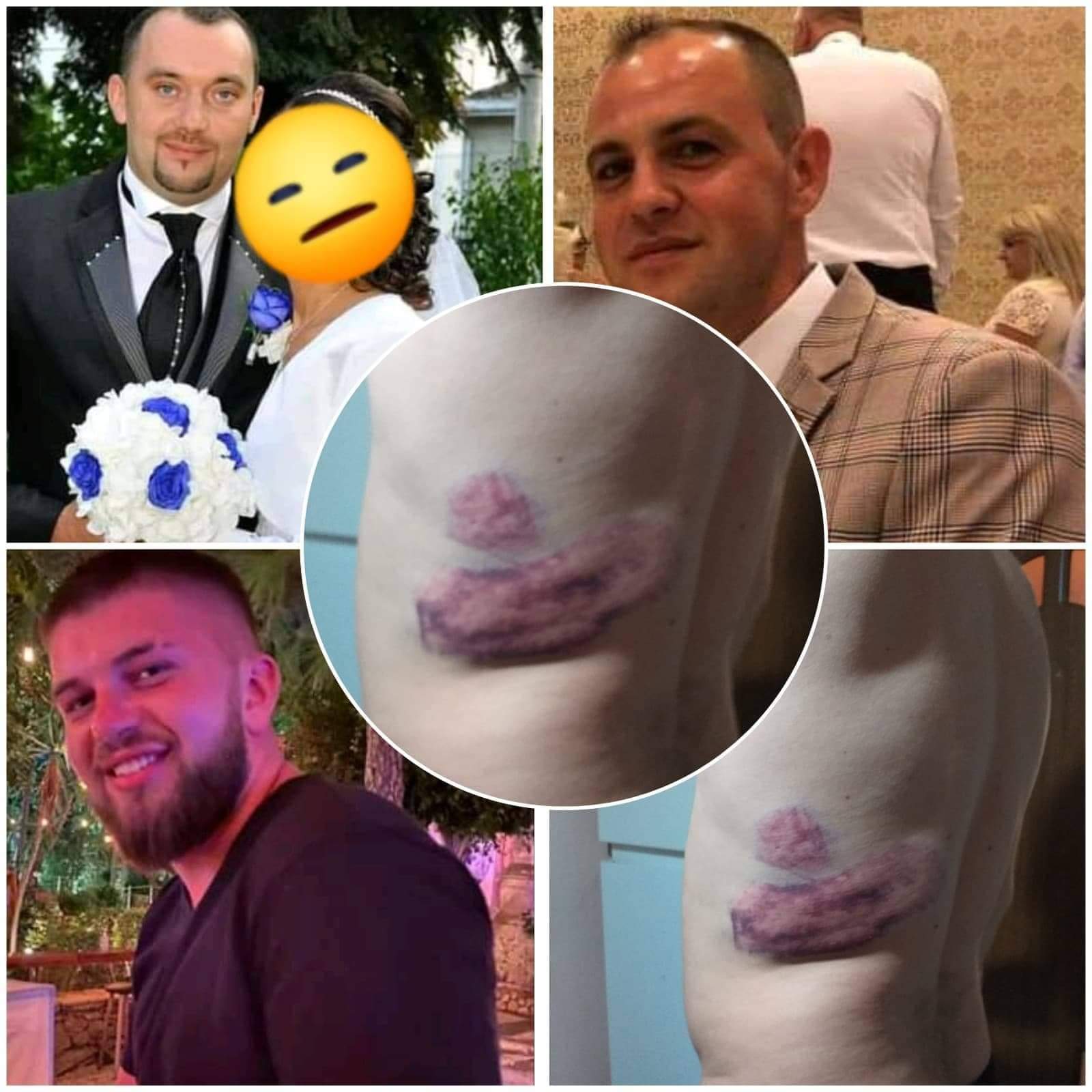 Mocănița în care se aflau peste 150 de turişti a. Un È™ofer AcuzÄƒ PoliÈ›ia CÄƒ L A BÄƒtut Crunt Pentru A Se RÄƒzbuna Au Vrut SÄƒ MÄƒ ImpuÈ™te CÄƒutau Un CuÈ›it Foto Stiri De Cluj