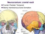 Solution Cranial Skeleton Neurocranium Presentation Studypool