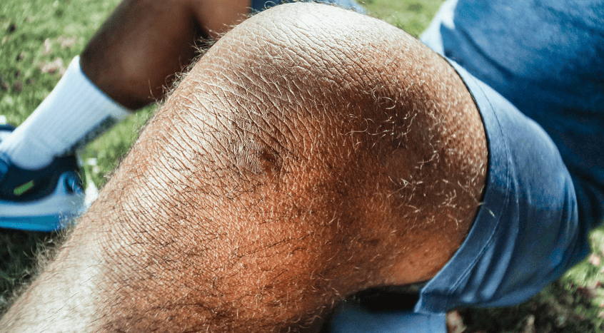 The Benefits of Partial Knee Replacement