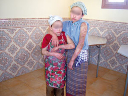 العنف ضد خادمات البيوت