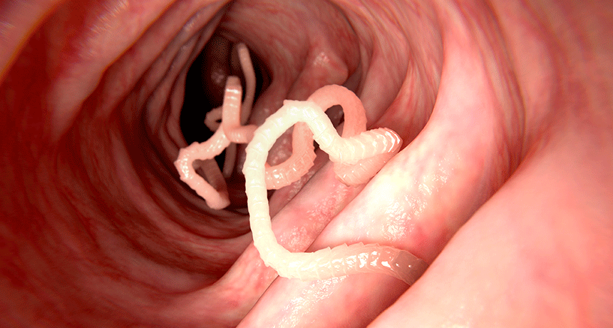 How To Get Rid Of Parasites Naturally