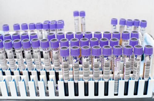 The Jersey Practice About Medical Tests And How To Get Your Results The Jersey Practice Limited Heston Health Clinic Cranford Lane Hounslow.