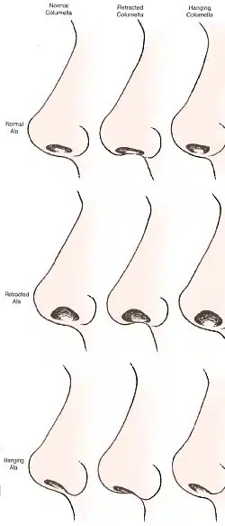 pics Perfect Male Nose Profile becker rhinoplasty