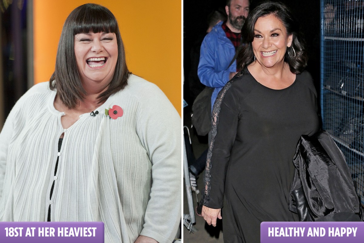 photo Dawn French the sun