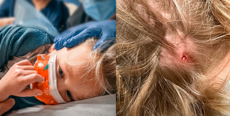 photo Child Staples In Head did riley busby do to get stitches