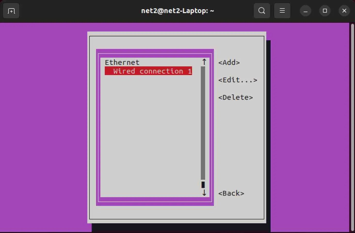How To Configure Network Settings In Ubuntu 22.04 16 How to configure network settings in ubuntu 22. 04 8