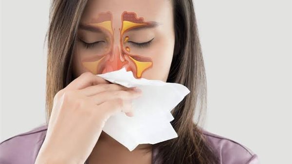 أعراض التهاب الجيوب الأنفية، ومتى تذهب للطبيب