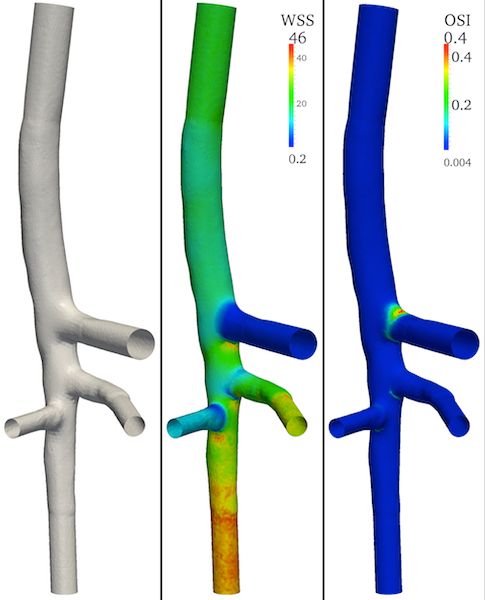 Mapping And Patching Error In Vmtk Vmtk 3d Slicer Community - Ultra HD Space Texture - Mobile