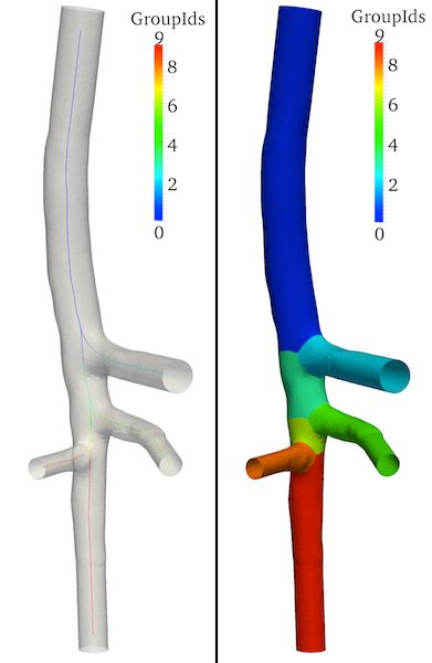 Mapping And Patching Vmtk The Vascular Modelling Toolkit - Space Pictures - Modern Mobile Collection
