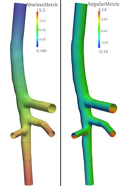 Mapping And Patching Vmtk The Vascular Modelling Toolkit - Premium Space Design - Retina